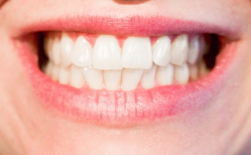 Obecna technologia wykorzystywana w salonach stomatologii estetycznej może sprawić, że odzyskamy śliczny uśmiech.